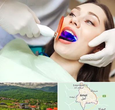 دندانپزشکی بدون درد در آمل