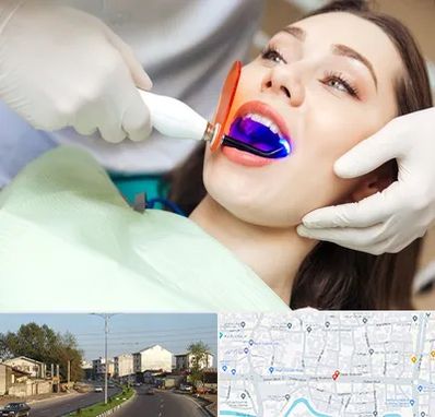 دندانپزشکی بدون درد در ضیابری رشت