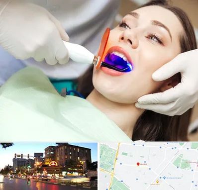 دندانپزشکی بدون درد در بلوار سجاد مشهد