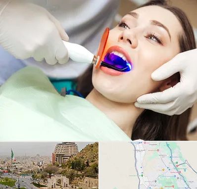 دندانپزشکی بدون درد در فرهنگ شهر شیراز