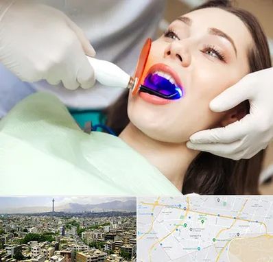 دندانپزشکی بدون درد در منطقه 8 تهران