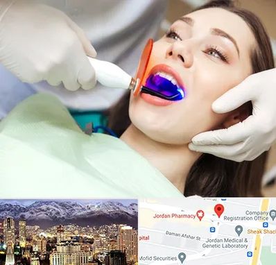 دندانپزشکی بدون درد در جردن 