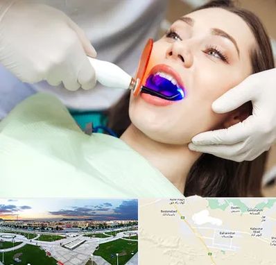 دندانپزشکی بدون درد در بهارستان اصفهان