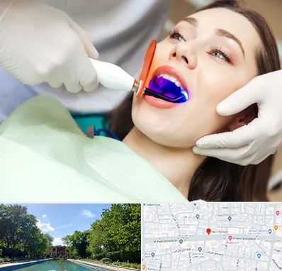 دندانپزشکی بدون درد در هشت بهشت اصفهان