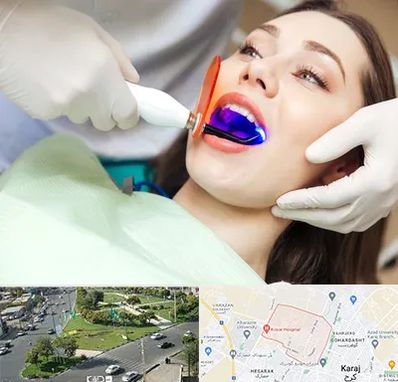 دندانپزشکی بدون درد در شاهین ویلا کرج
