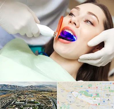 دندانپزشکی بدون درد در منطقه 21 تهران