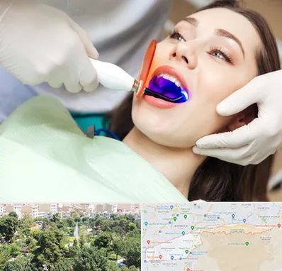 دندانپزشکی بدون درد در منطقه 13 تهران