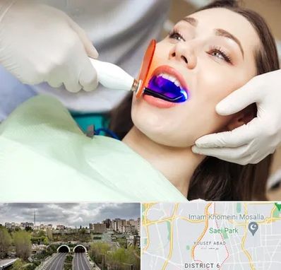 دندانپزشکی بدون درد در یوسف آباد 