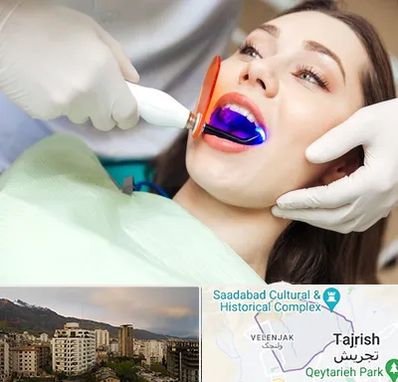 دندانپزشکی بدون درد در زعفرانیه 