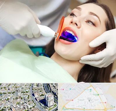 دندانپزشکی بدون درد در قاسم آباد مشهد
