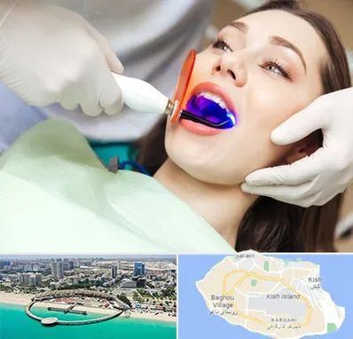 دندانپزشکی بدون درد در کیش