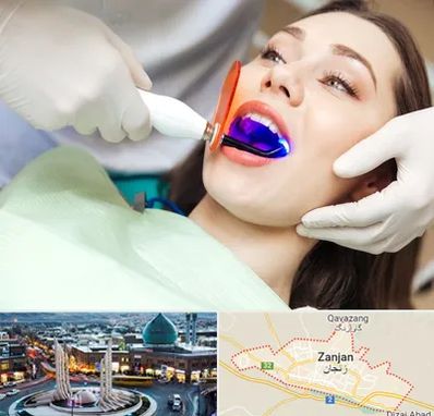 دندانپزشکی بدون درد در زنجان
