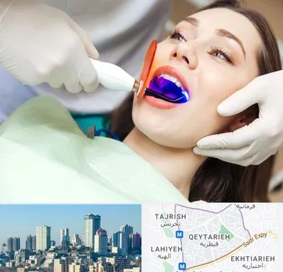 دندانپزشکی بدون درد در قیطریه 