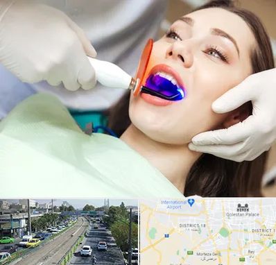 دندانپزشکی بدون درد در جنوب تهران 