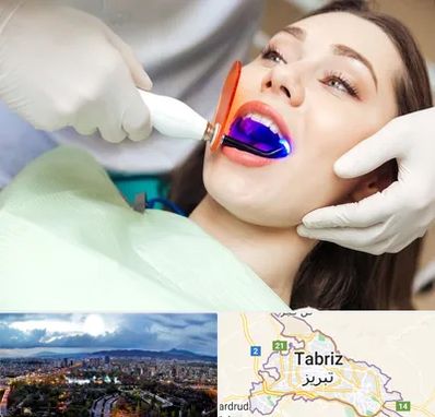 دندانپزشکی بدون درد در تبریز