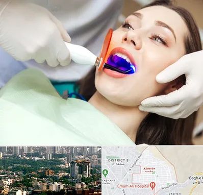 دندانپزشکی بدون درد در عظیمیه کرج 