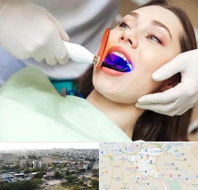دندانپزشکی بدون درد در منطقه 20 تهران