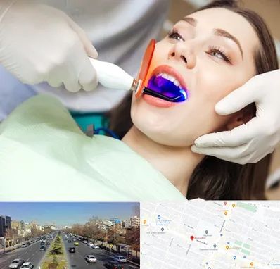 دندانپزشکی بدون درد در بلوار معلم مشهد