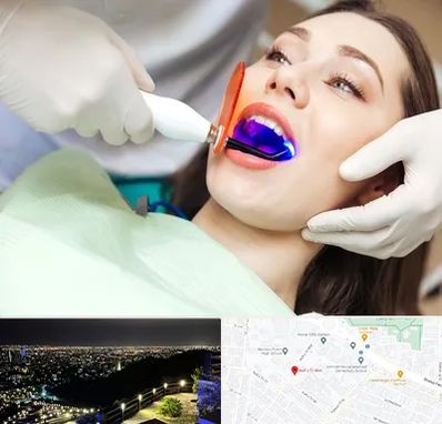 دندانپزشکی بدون درد در هفت تیر مشهد