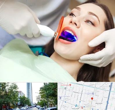 دندانپزشکی بدون درد در امامت مشهد