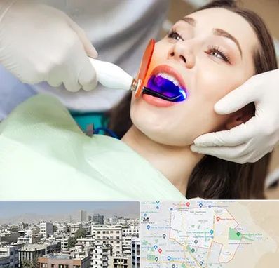 دندانپزشکی بدون درد در منطقه 14 تهران