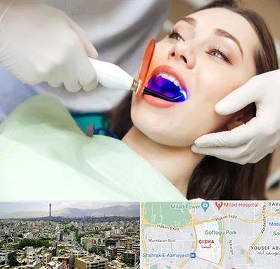 دندانپزشکی بدون درد در گیشا 
