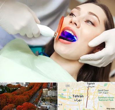 دندانپزشکی بدون درد در ولیعصر 