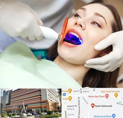 دندانپزشکی بدون درد در سهروردی 