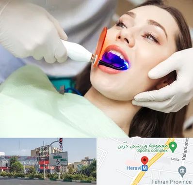 دندانپزشکی بدون درد در هروی 