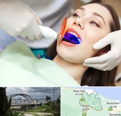 دندانپزشکی بدون درد در چالوس