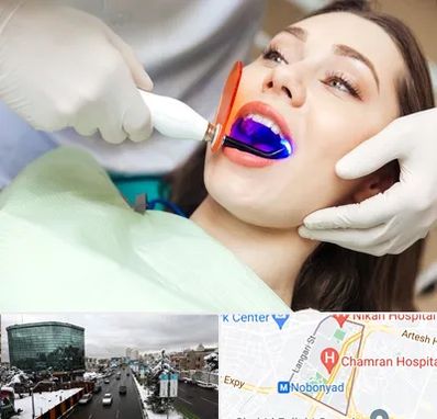 دندانپزشکی بدون درد در اقدسیه 