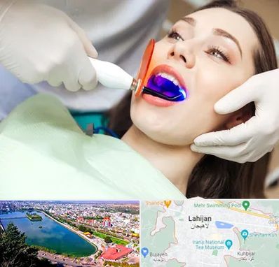 دندانپزشکی بدون درد در لاهیجان