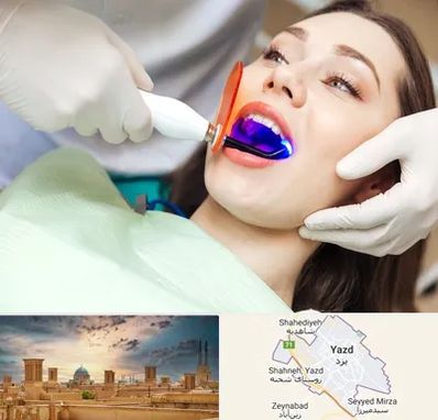 دندانپزشکی بدون درد در یزد