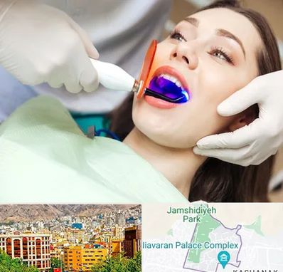 دندانپزشکی بدون درد در نیاوران 