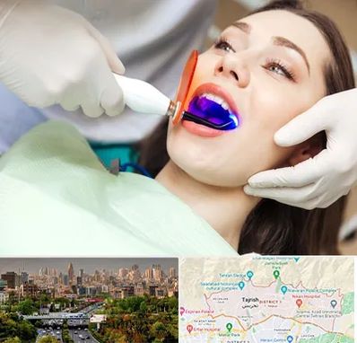 دندانپزشکی بدون درد در منطقه 1 تهران