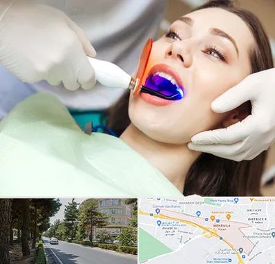دندانپزشکی بدون درد در مهرویلا کرج