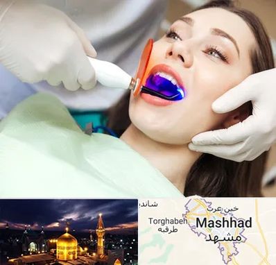 دندانپزشکی بدون درد در مشهد