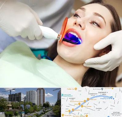 دندانپزشکی بدون درد در اندرزگو