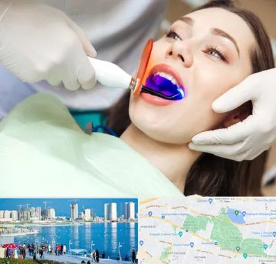 دندانپزشکی بدون درد در چیتگر 