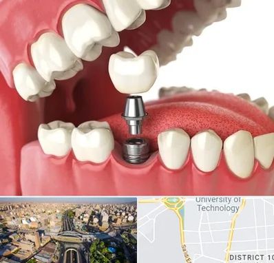 متخصص پروتز دندان در استاد معین