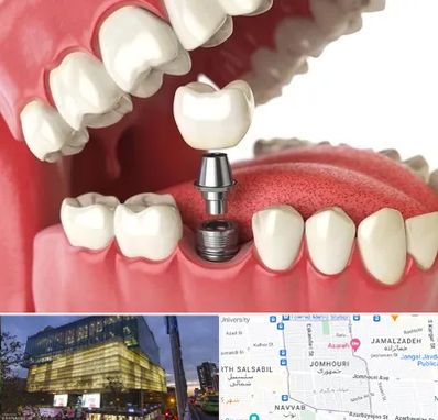 متخصص پروتز دندان در جمهوری