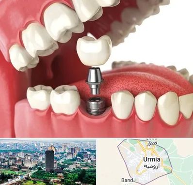 متخصص پروتز دندان در ارومیه
