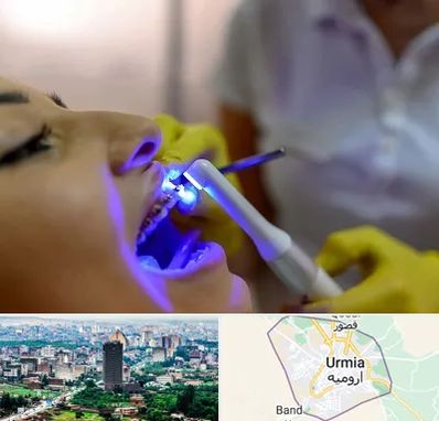 دندانپزشکی با لیزر در ارومیه