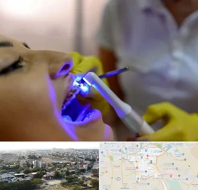 دندانپزشکی با لیزر در منطقه 20 تهران