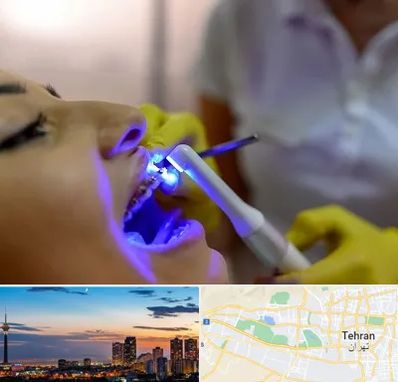 دندانپزشکی با لیزر در غرب تهران 