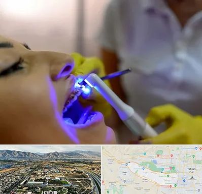 دندانپزشکی با لیزر در منطقه 21 تهران