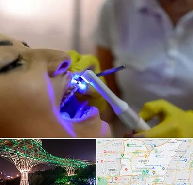 دندانپزشکی با لیزر در منطقه 3 تهران
