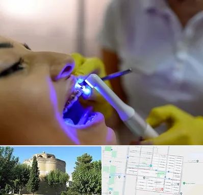 دندانپزشکی با لیزر در مرداویج اصفهان