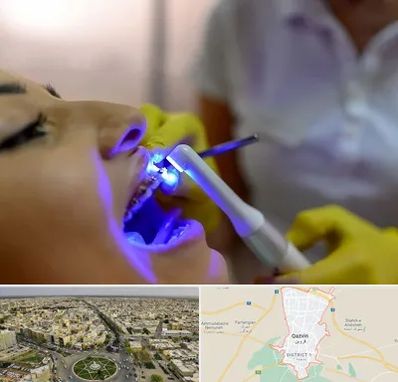 دندانپزشکی با لیزر در قزوین