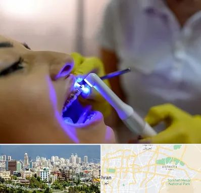 دندانپزشکی با لیزر در شرق تهران 